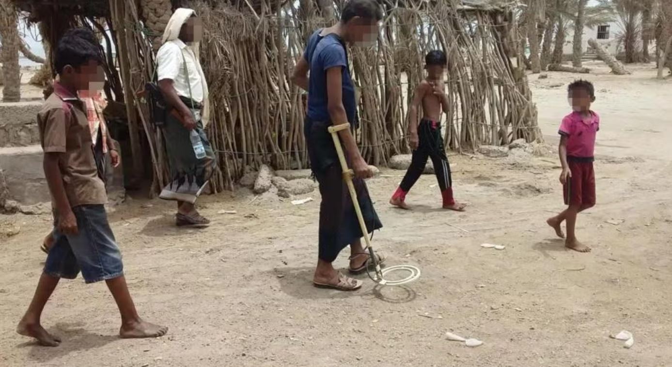 الألغام تواصل حصد أرواح الأطفال في اليمن: 17 ضحية في انفجار مؤلم