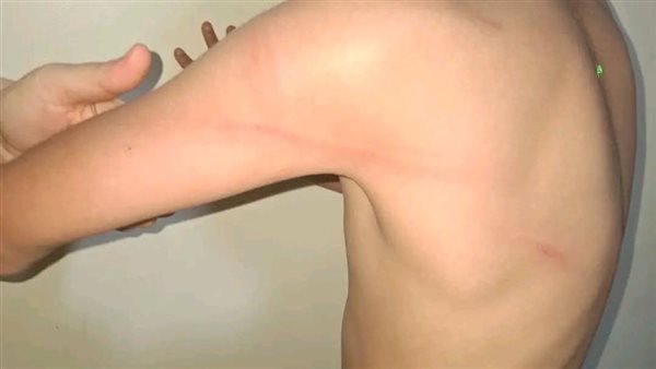 إيقاف معلم وإحالته للتحقيق بسبب اعتداء على طالب في الإسكندرية