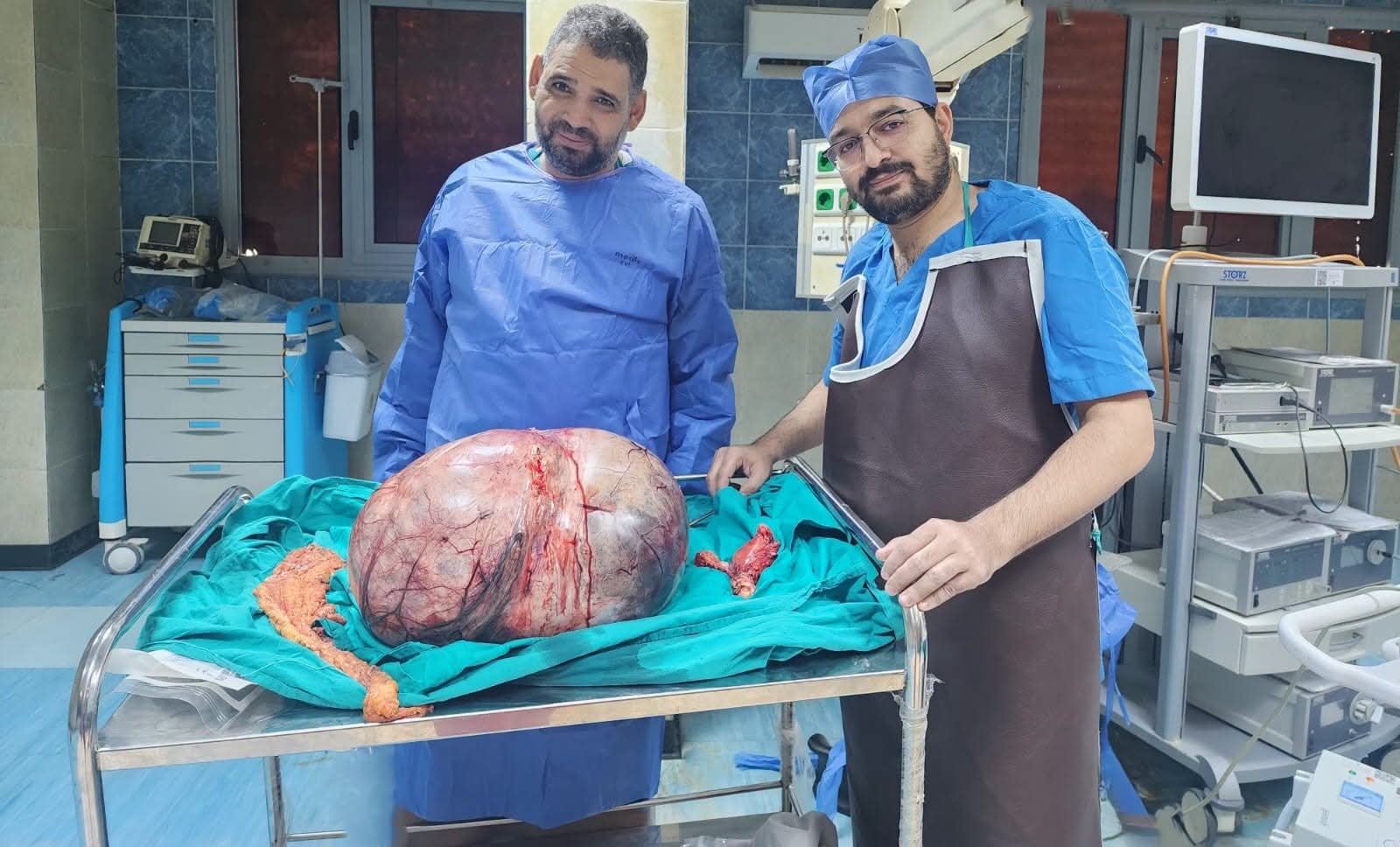 إنجاز طبي جديد بالمنيا.. استئصال ورم مبيضي عملاق يزن 24 كيلوجرامًا